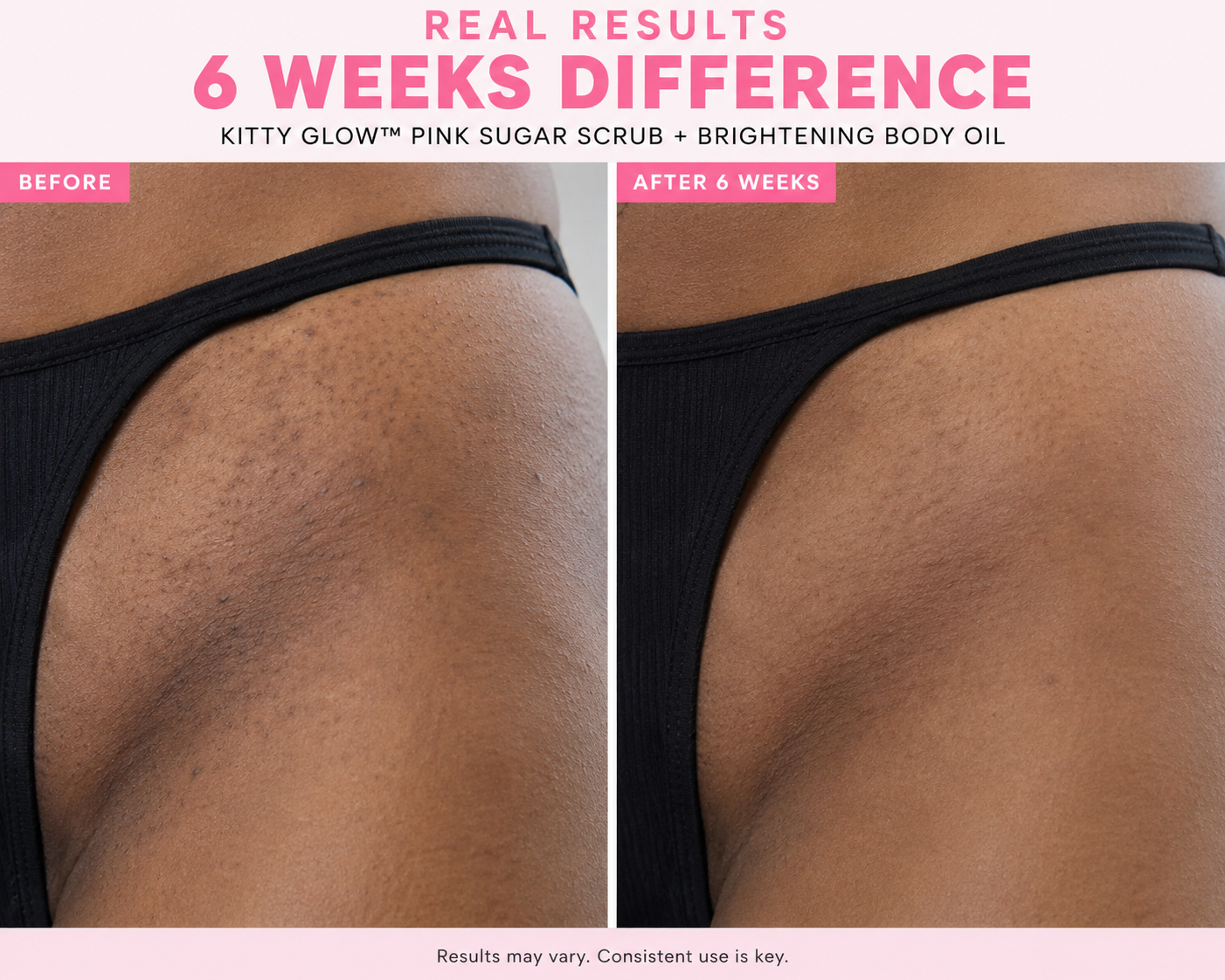 KITTY GLOW™ Pink Sugar Glow Duo | Exfoliating Polish & Brightening Body Oil Set
